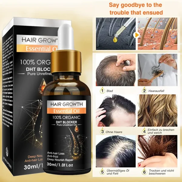 Custom Logo Private Label All Natural Formula Hair Growth Oil Serum Nourishing Scalp Rapid Hair Thickening Oil Organic Hair Oil - Image 3