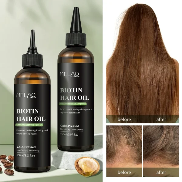 Private Label Essential Hair Loss Oil Growth Oil Hair Strengthening Dandruff Itchy Deep Biotin Hair Oil - Image 4