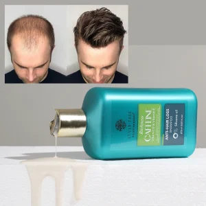 Keratin Queen OEM Caffeine Shampoo Formula Strong Effective Anti Hair Loss Treatments Shampoo for Hair Regrowth