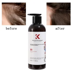 Private Label Organic Fast-Growing Ginger Shampoo Vegan Ingredient Anti-Hair Loss Formula Moisturizing Shampoo