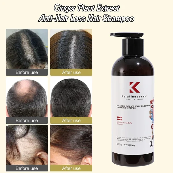 Private Label Organic Fast-Growing Ginger Shampoo Vegan Ingredient Anti-Hair Loss Formula Moisturizing Shampoo - Image 2
