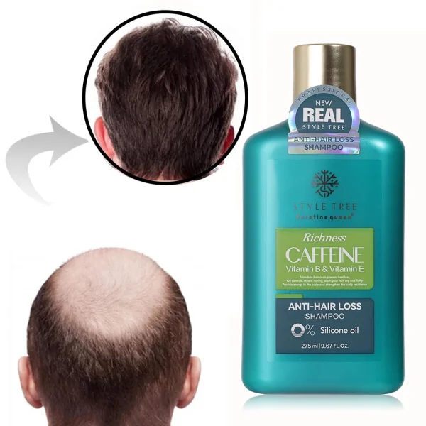 OEM Caffeine Formula Strong Effective Anti Hair Loss Treatments Hair Regrowth Shampoos