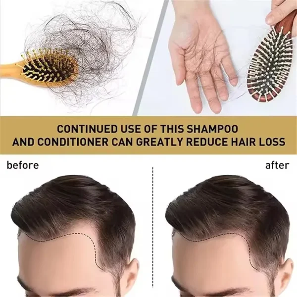 Hair Growth Products Wholesale Natural 100% Herbal Anti Dandruff Treatment Hair Loss Ginger Big Capacity 5L Shampoo - Image 4