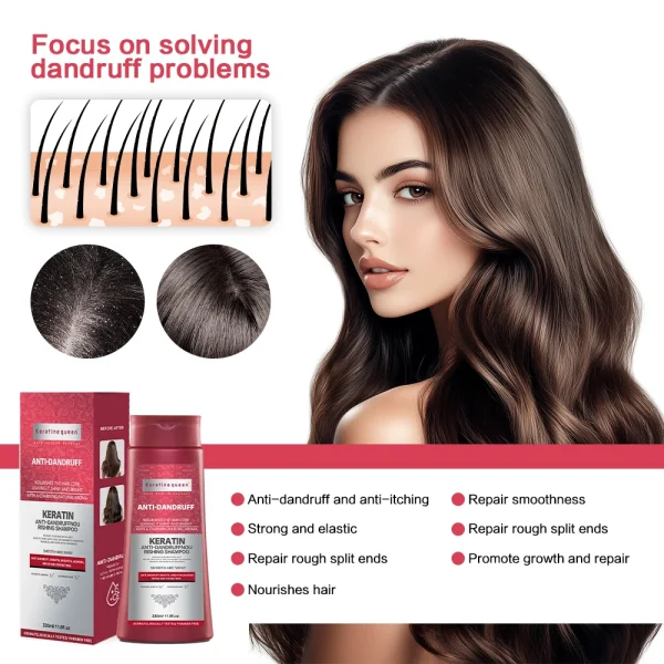 Private Label Oil Control Soft Hair Shampoo Anti-dandruff Fragrance Shampoo - Image 6