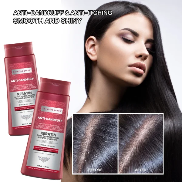 Private Label Oil Control Soft Hair Shampoo Anti-dandruff Fragrance Shampoo - Image 5