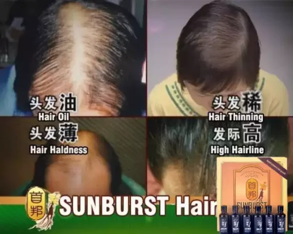 Orignal Sunburst Organic Herbal Hair Loss and Growth Treatment Oil for Fine and Damaged Hair Nourishing Beauty Care Products